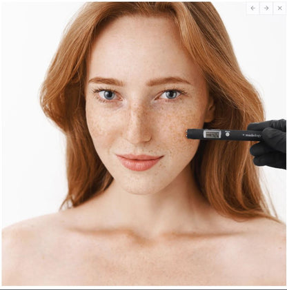 Skin Analysis Device